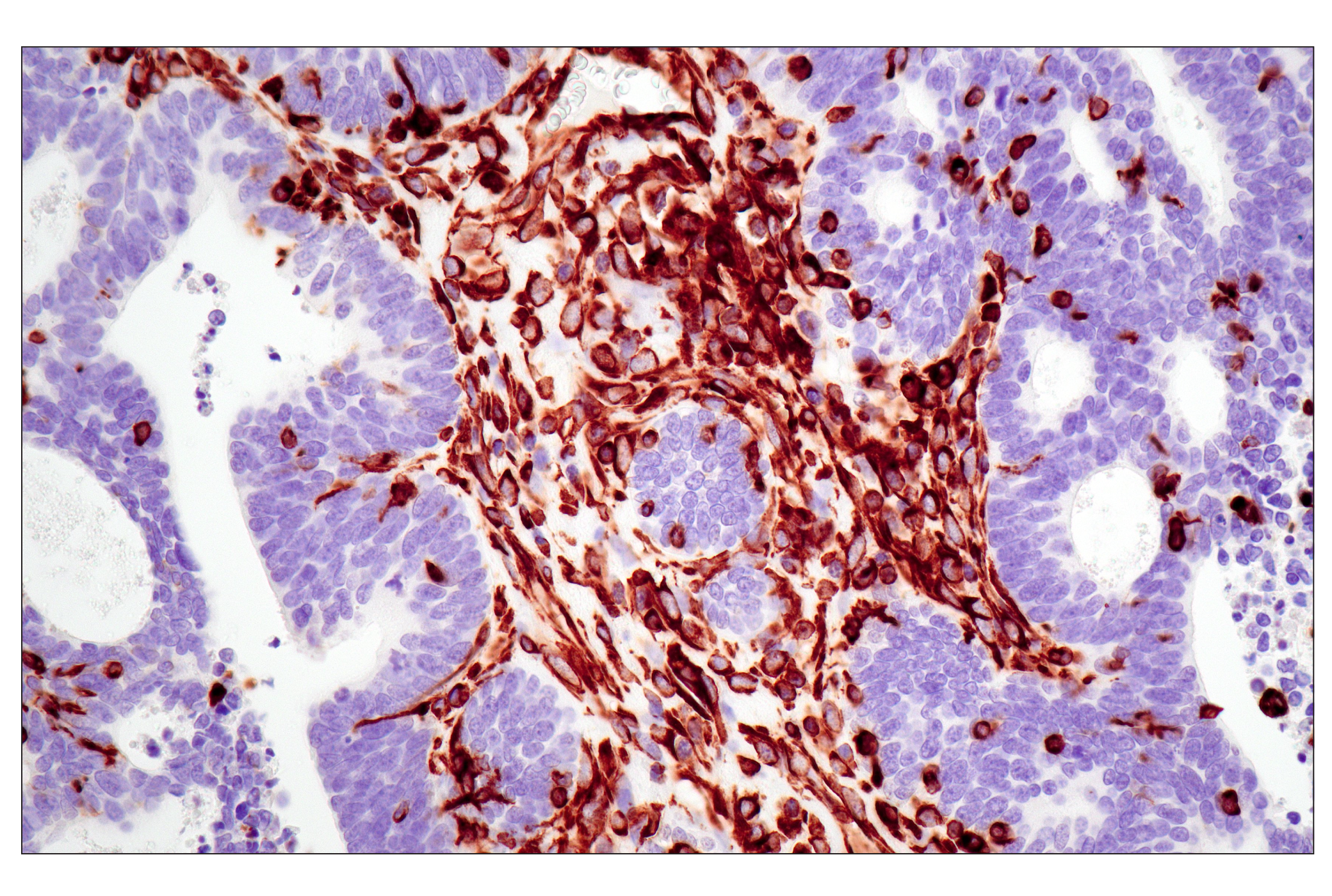  Image 29: Cytoskeletal Marker Antibody Sampler Kit