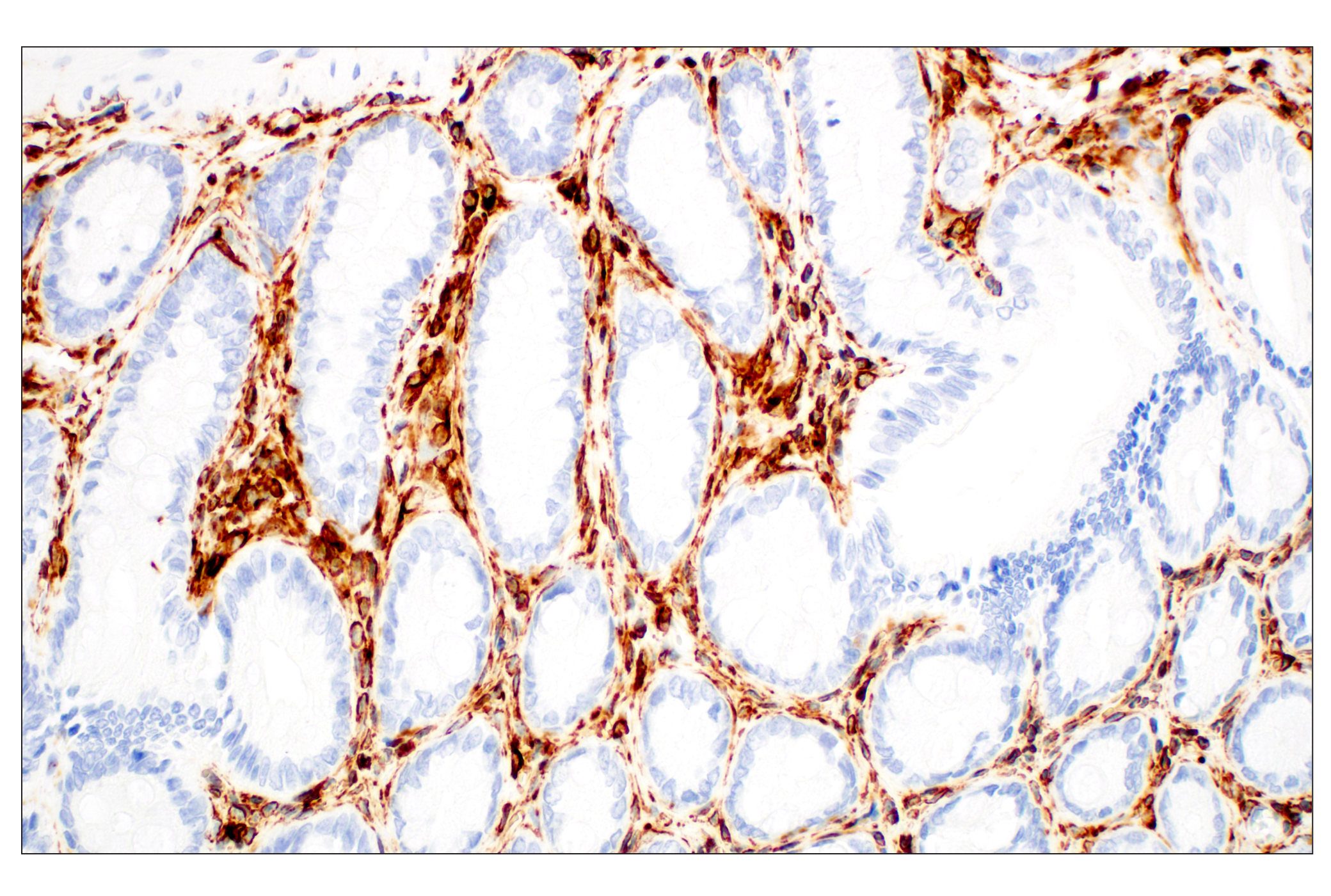 Image 38: Cell Fractionation Antibody Sampler Kit