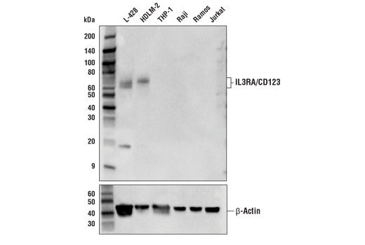 Western Blotting Image 1: IL3RA/CD123 Antibody
