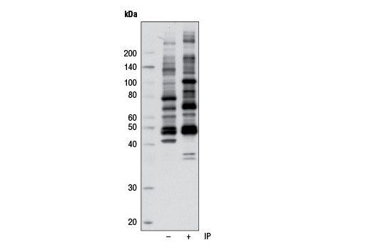Immunoprecipitation Image 1: Phospho-AMPK Substrate Motif [LXRXX(pS/pT) MultiMab®  Rabbit mAb mix