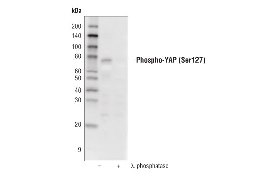 Western Blotting Image 1: Phospho-YAP (Ser127) (D9W2I) Rabbit mAb (Biotinylated)