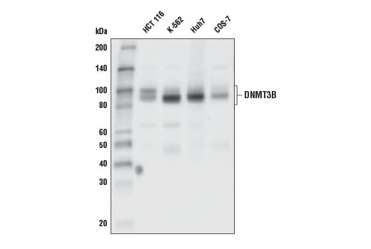  Image 4: DNA Methylation Antibody Sampler Kit