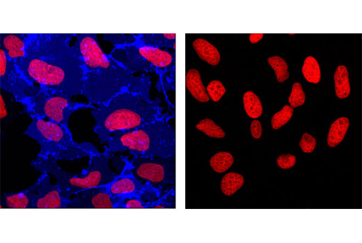 Immunofluorescence Image 1: SSEA4 (MC813) Mouse mAb (Alexa Fluor® 647 Conjugate)