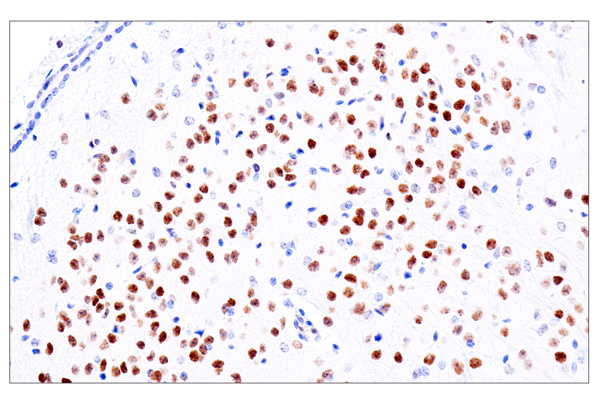  Image 49: Cardiogenesis Marker Antibody Sampler Kit