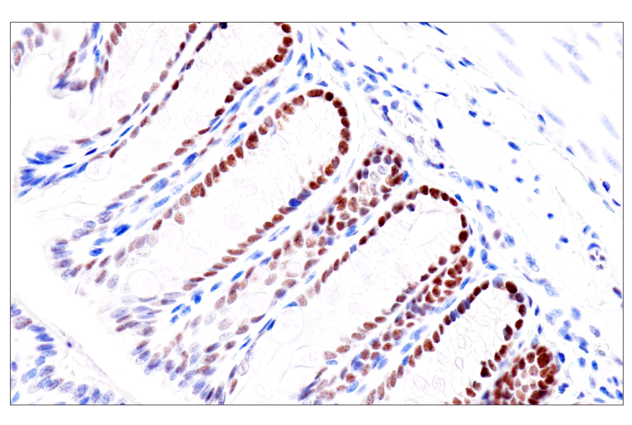  Image 49: Endodermal Lineage Marker Antibody Sampler Kit
