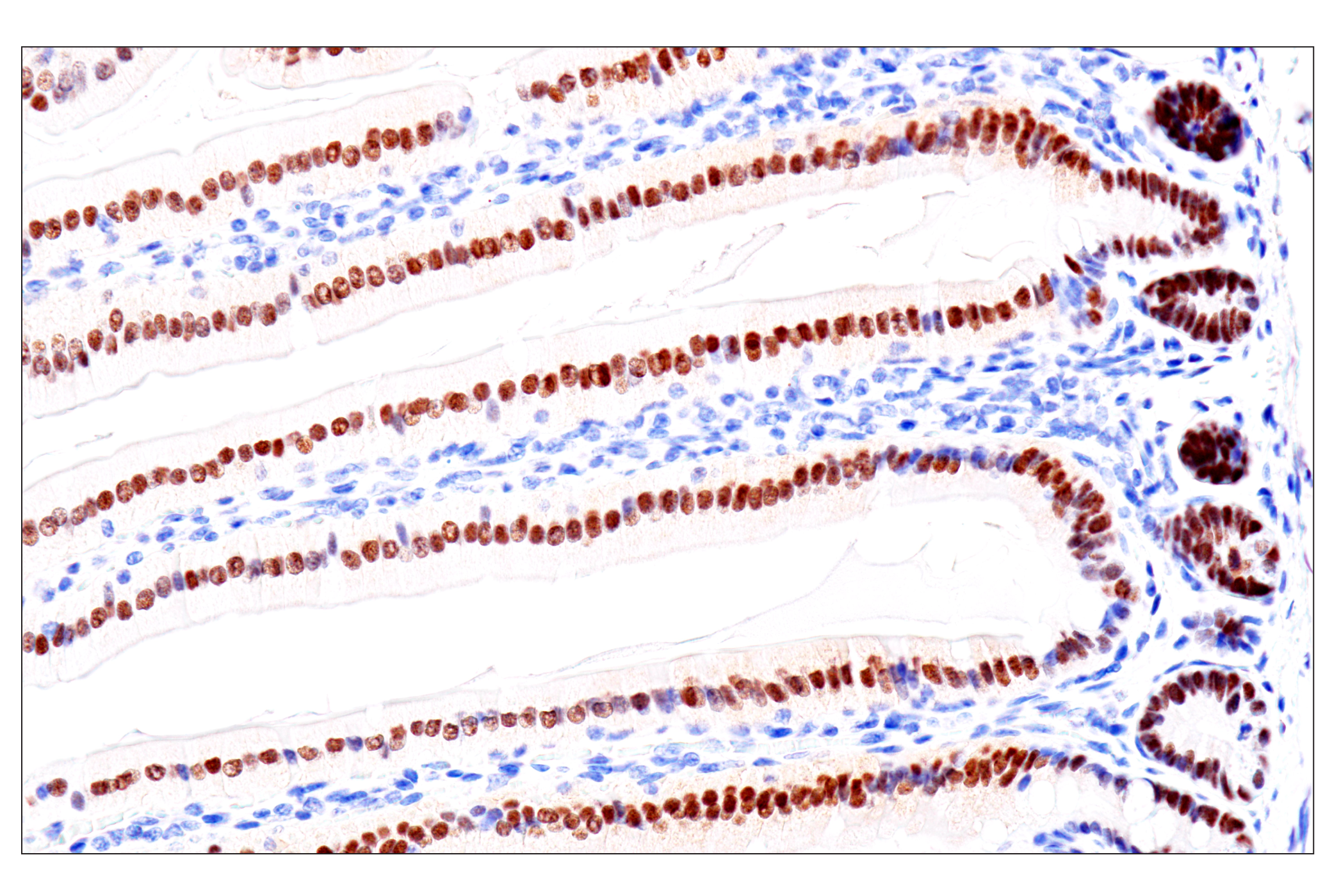  Image 48: Cardiogenesis Marker Antibody Sampler Kit