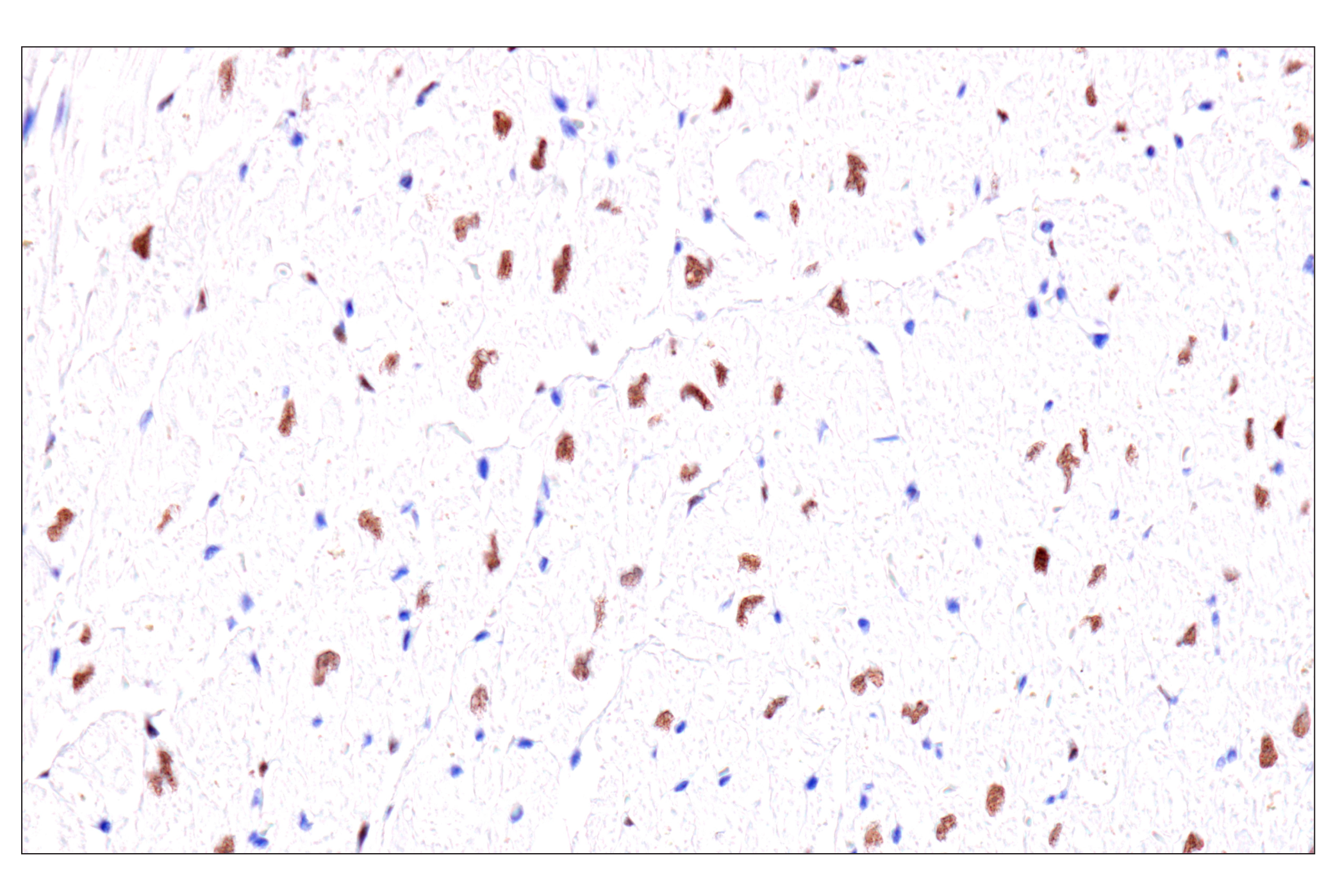 Image 42: Endodermal Lineage Marker Antibody Sampler Kit
