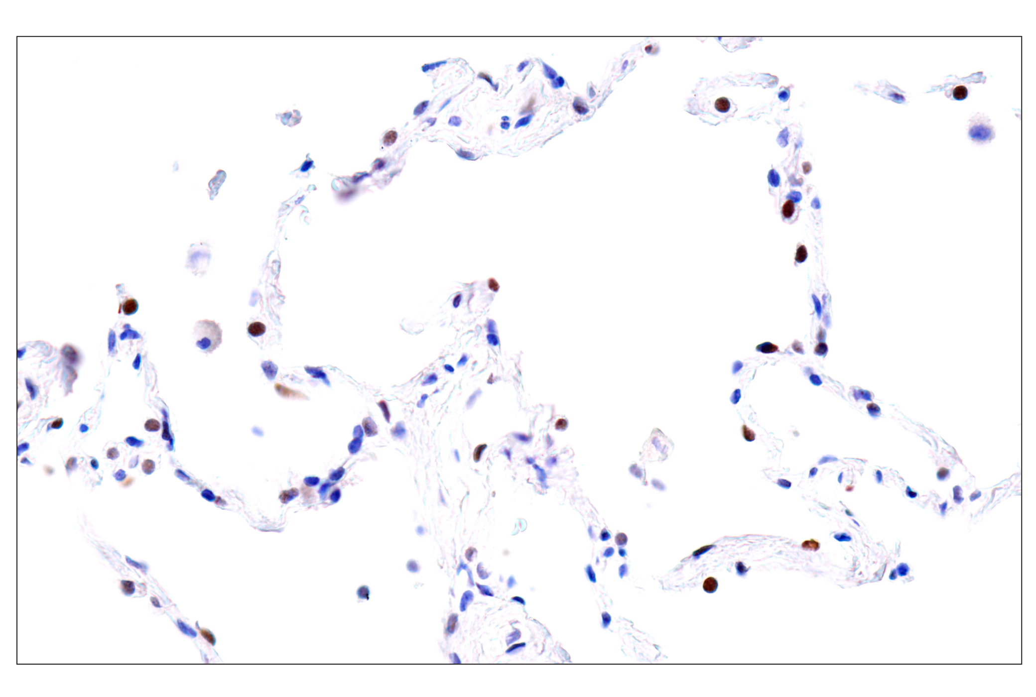  Image 41: Endodermal Lineage Marker Antibody Sampler Kit