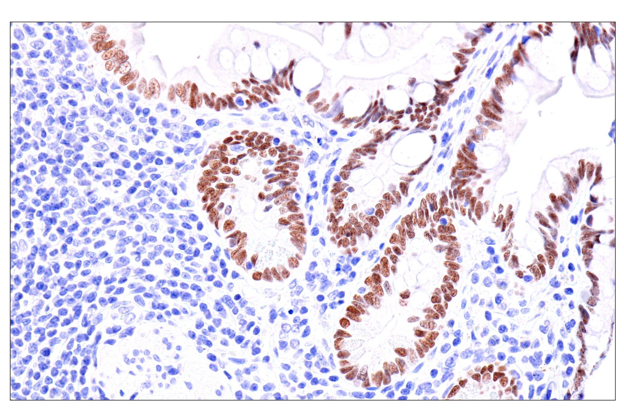  Image 34: Cardiogenesis Marker Antibody Sampler Kit