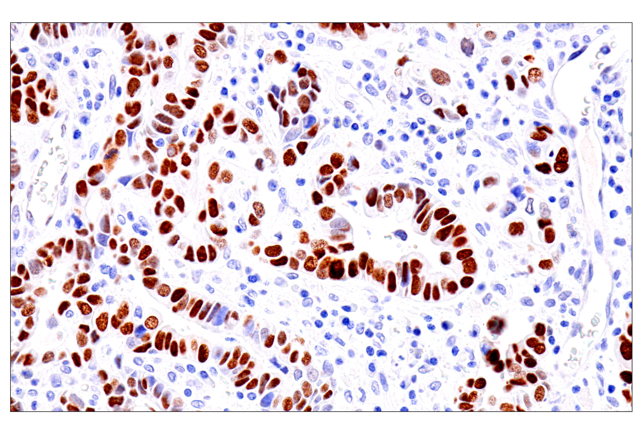  Image 7: Cardiogenesis Marker Antibody Sampler Kit