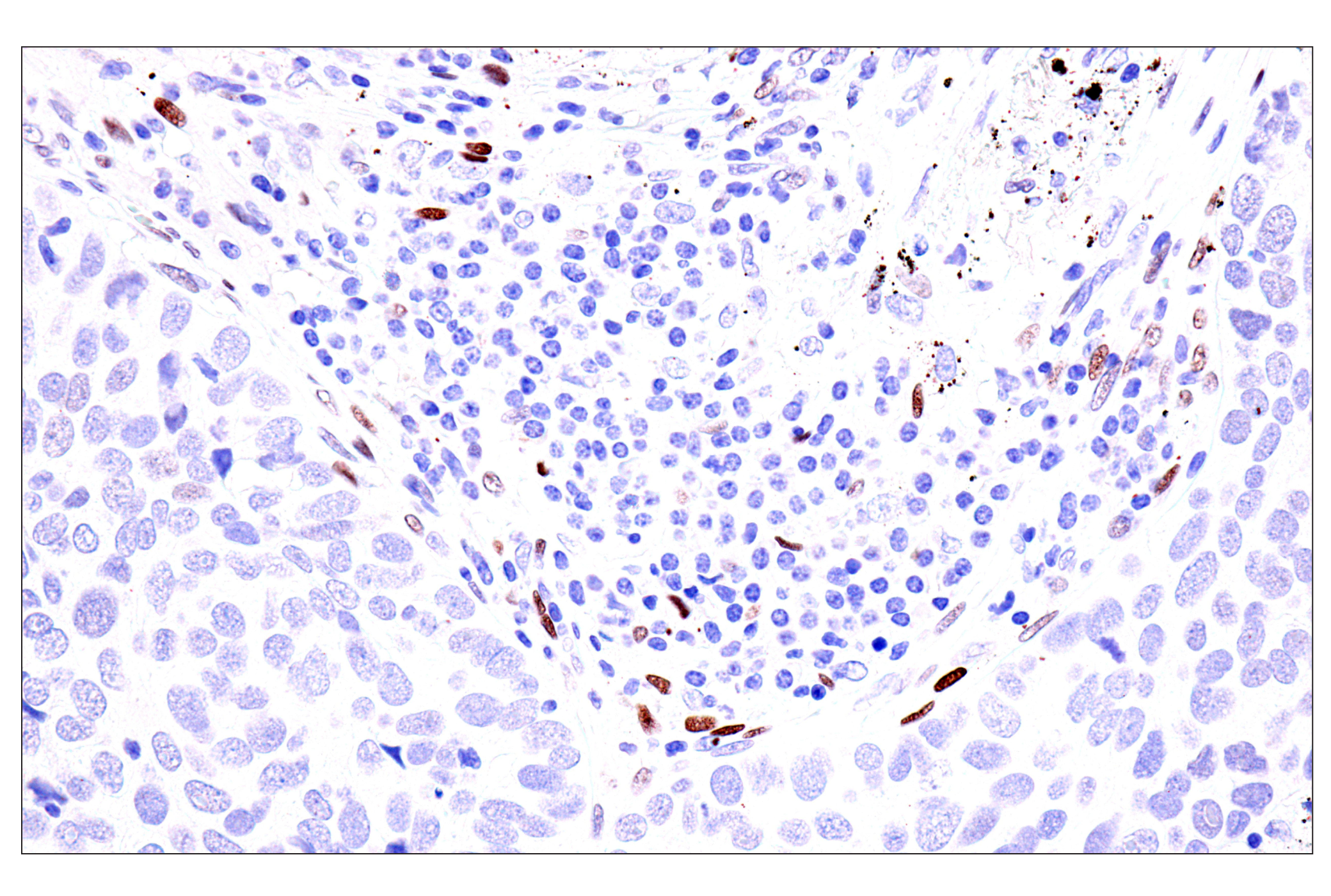  Image 26: Cardiogenesis Marker Antibody Sampler Kit