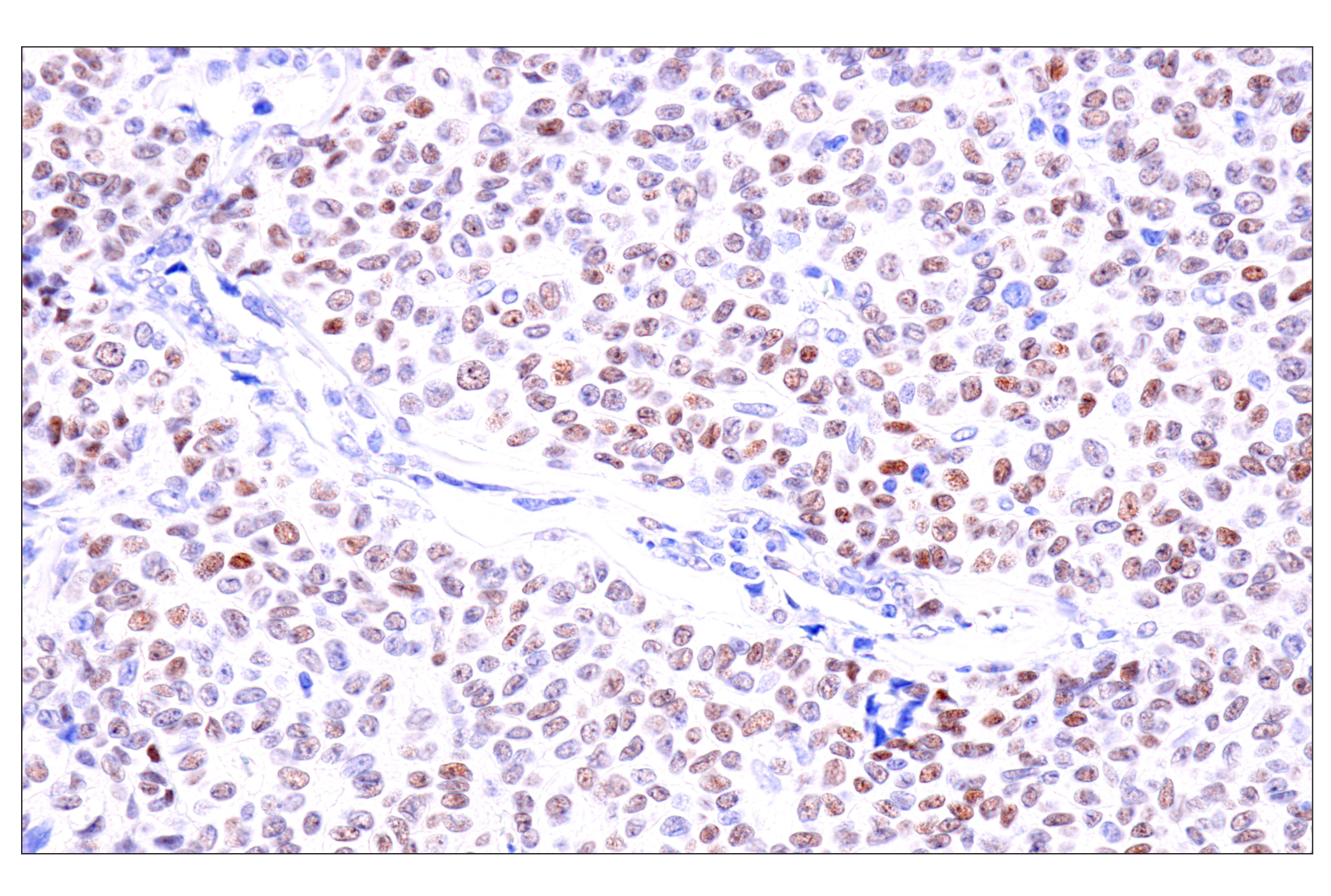  Image 15: Cardiogenesis Marker Antibody Sampler Kit