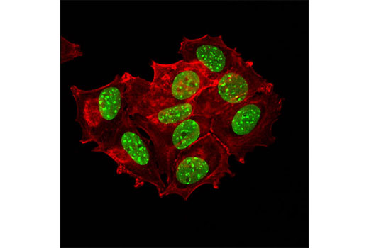 Immunofluorescence Image 1: KAP-1 (4E1) Mouse mAb
