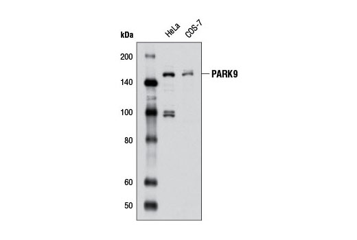Western Blotting Image 1: PARK9 Antibody