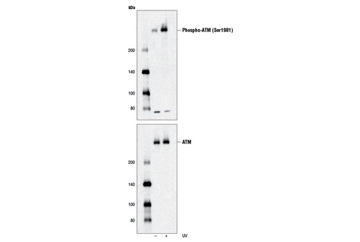  Image 5: DNA Damage Antibody Sampler Kit