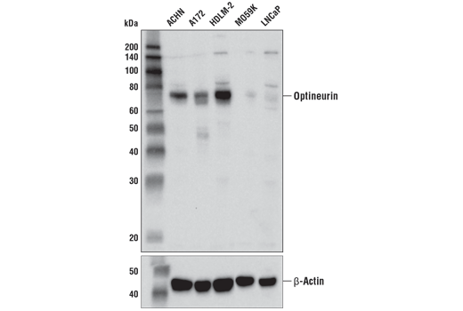  Image 2: SQSTM1/p62-like Receptor Antibody Sampler Kit