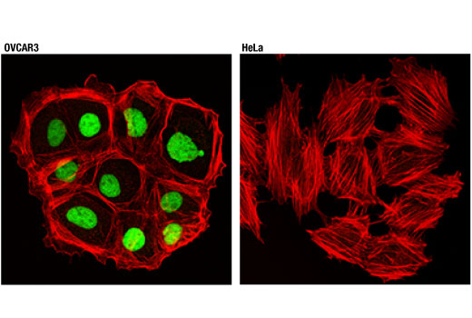 Immunofluorescence Image 1: PAX8 (D2S2I) Rabbit mAb