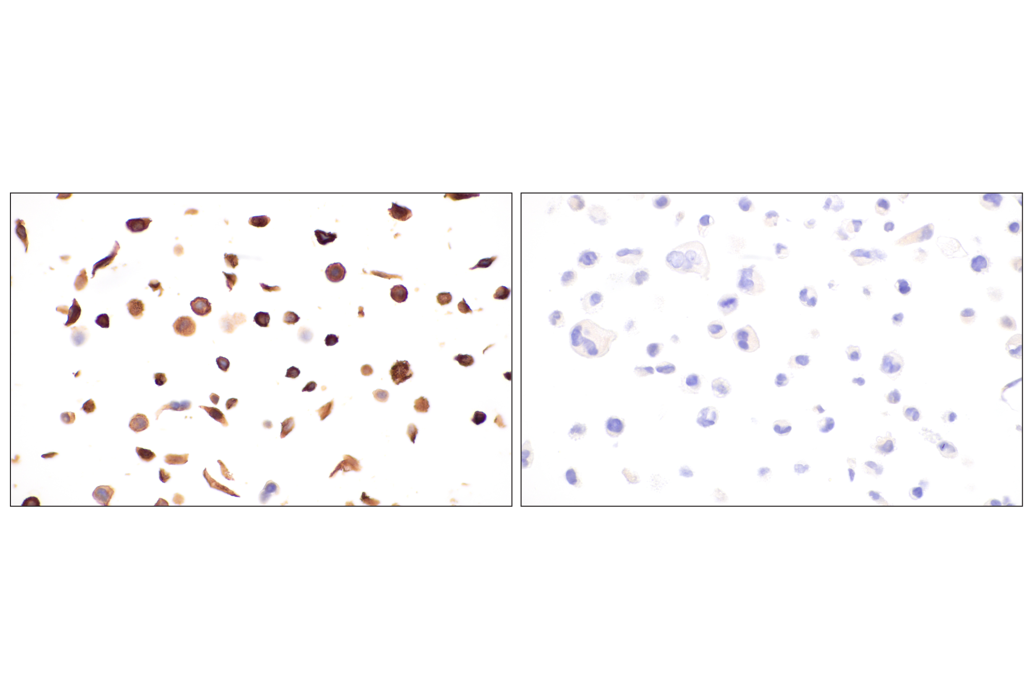 Immunohistochemistry Image 21: p75NTR (E7I3M) Rabbit mAb (BSA and Azide Free)
