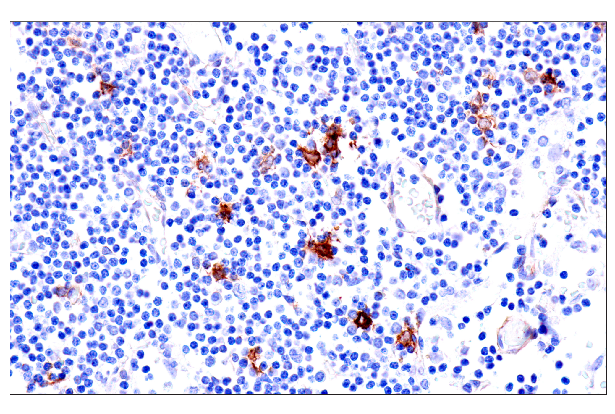 Immunohistochemistry Image 11: p75NTR (E7I3M) Rabbit mAb (BSA and Azide Free)
