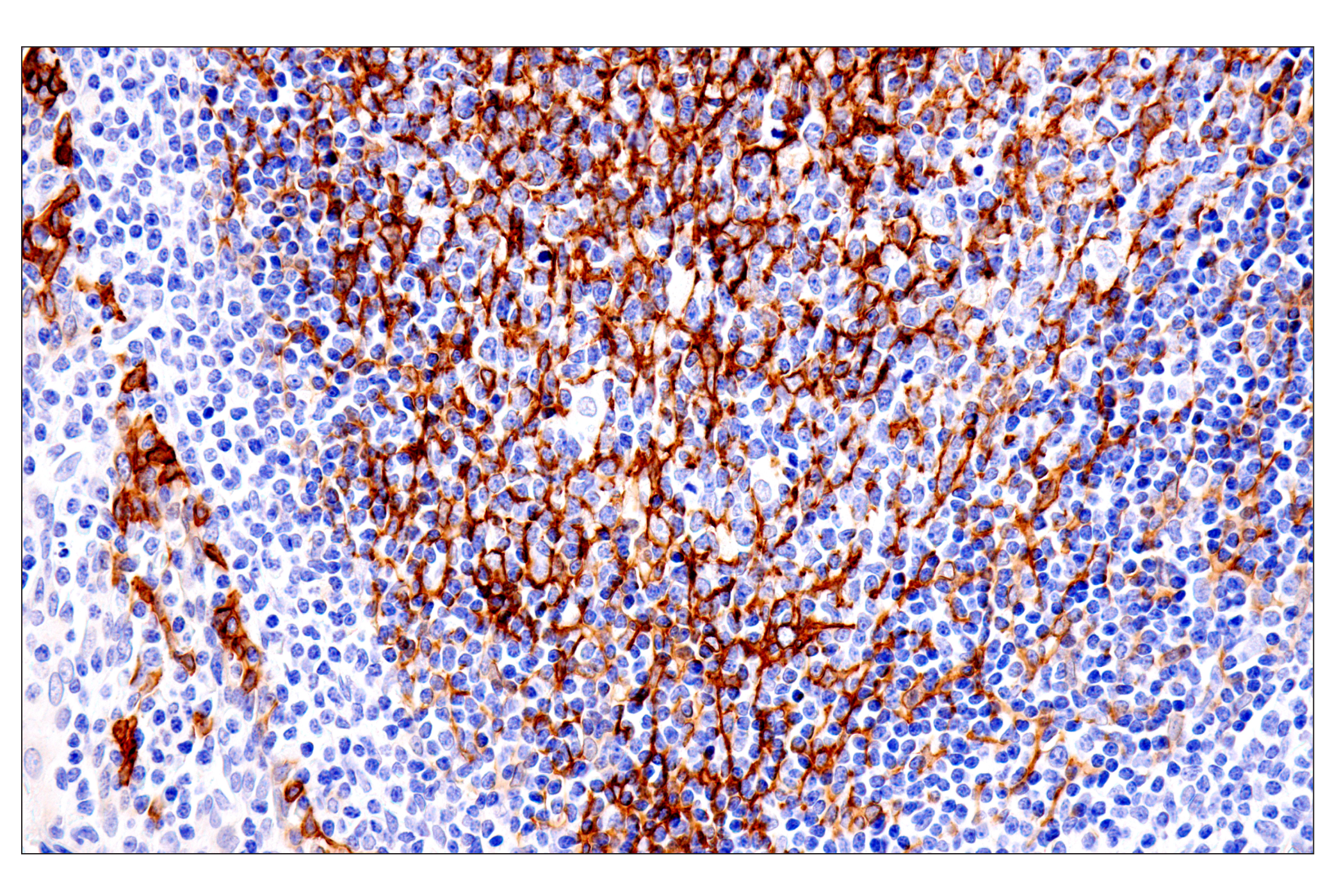 Immunohistochemistry Image 6: p75NTR (E7I3M) Rabbit mAb (BSA and Azide Free)