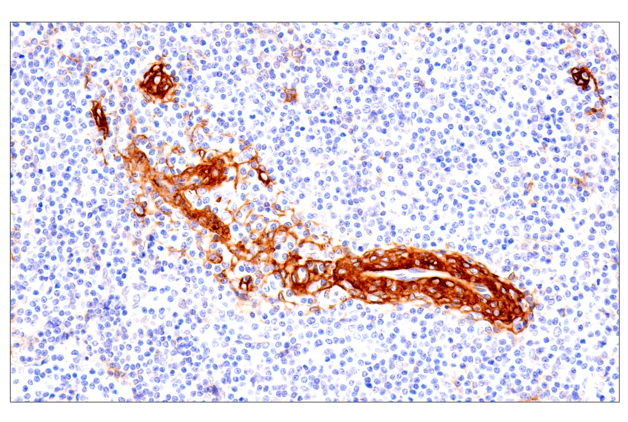 Immunohistochemistry Image 5: p75NTR (E7I3M) Rabbit mAb (BSA and Azide Free)