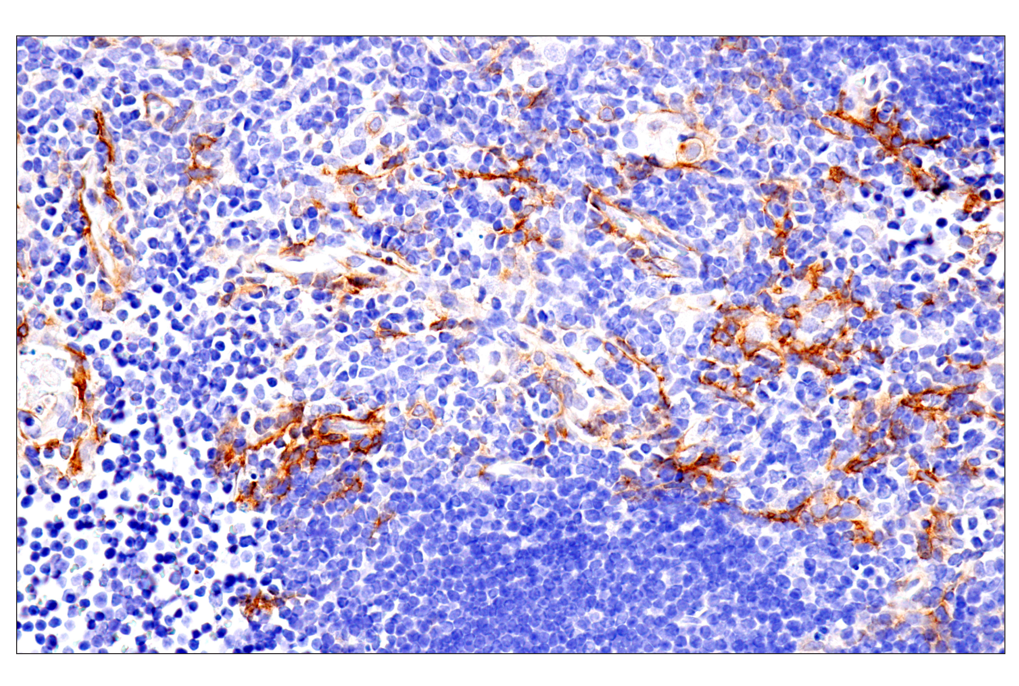 Immunohistochemistry Image 17: p75NTR (E7I3M) Rabbit mAb (BSA and Azide Free)