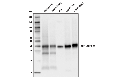  Image 17: Gluconeogenesis Antibody Sampler Kit