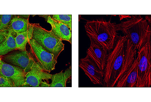 Immunofluorescence Image 1: LIN28A (6D1F9) Mouse mAb