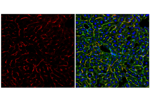 Immunofluorescence Image 3: CD206/MRC1 (E6T5J) XP® Rabbit mAb (Alexa Fluor® 594 Conjugate)