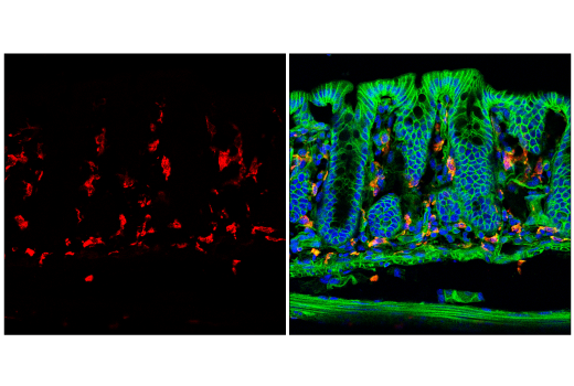 Immunofluorescence Image 1: CD206/MRC1 (E6T5J) XP® Rabbit mAb (Alexa Fluor® 594 Conjugate)