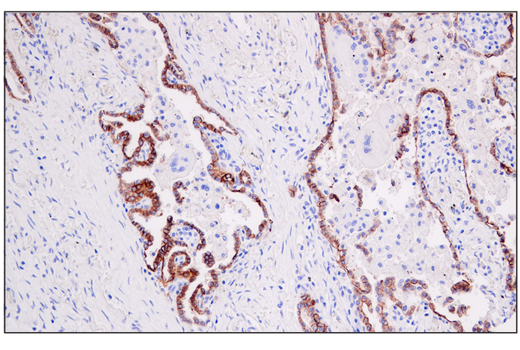 Image 29: Astrocyte Markers Antibody Sampler Kit