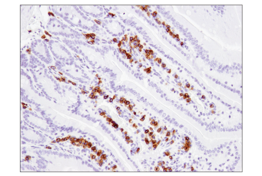 Immunohistochemistry Image 4: CD79B (D7V2F) Rabbit mAb (BSA and Azide Free)