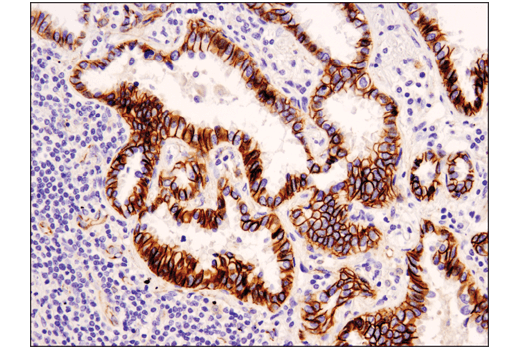 Immunohistochemistry Image 1: Catenin δ-1 (D7S2M) XP® Rabbit mAb