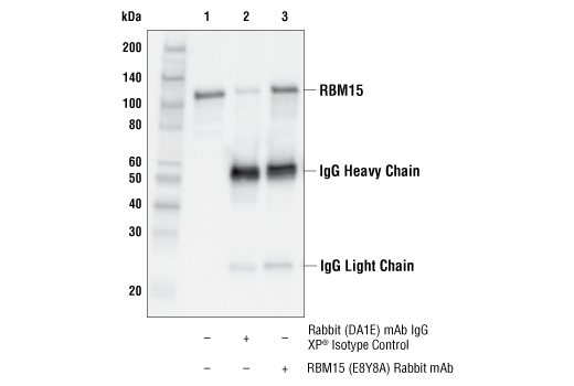 Immunoprecipitation Image 1: RBM15 (E8Y8A) Rabbit mAb