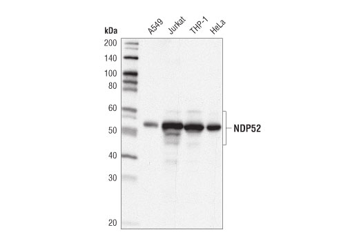  Image 3: SQSTM1/p62-like Receptor Antibody Sampler Kit
