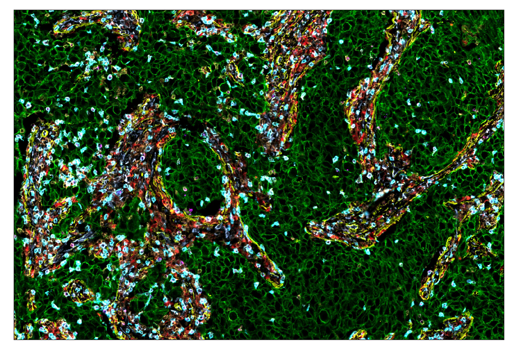 Immunohistochemistry Image 1: CD68 (D4B9C) & CO-0007-750 SignalStar™ Oligo-Antibody Pair
