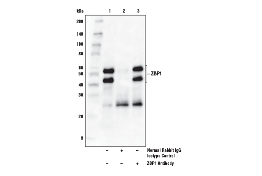 Immunoprecipitation Image 1: ZBP1 Antibody