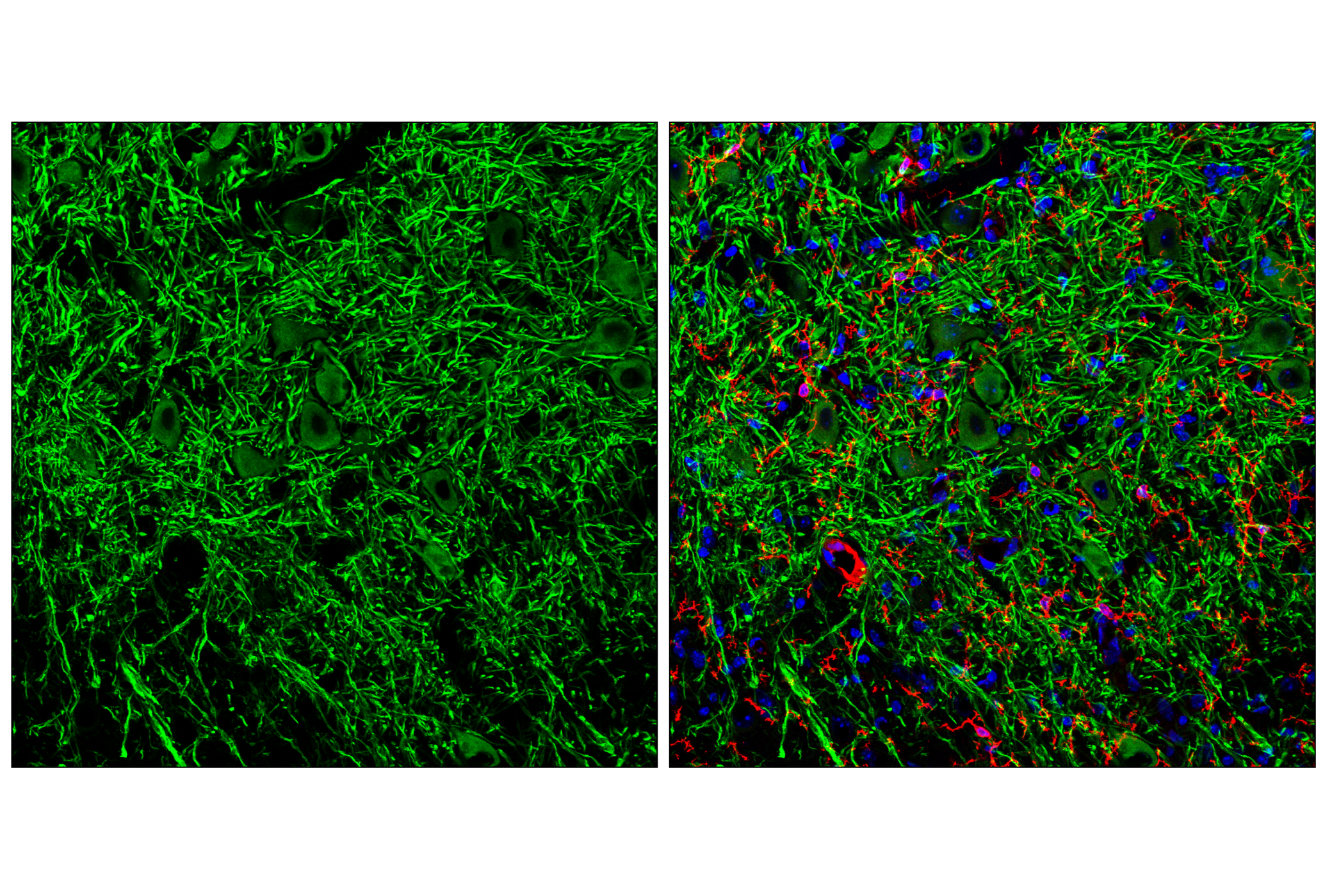 Immunofluorescence Image 3: GPR52 (E9D8W) Rabbit mAb
