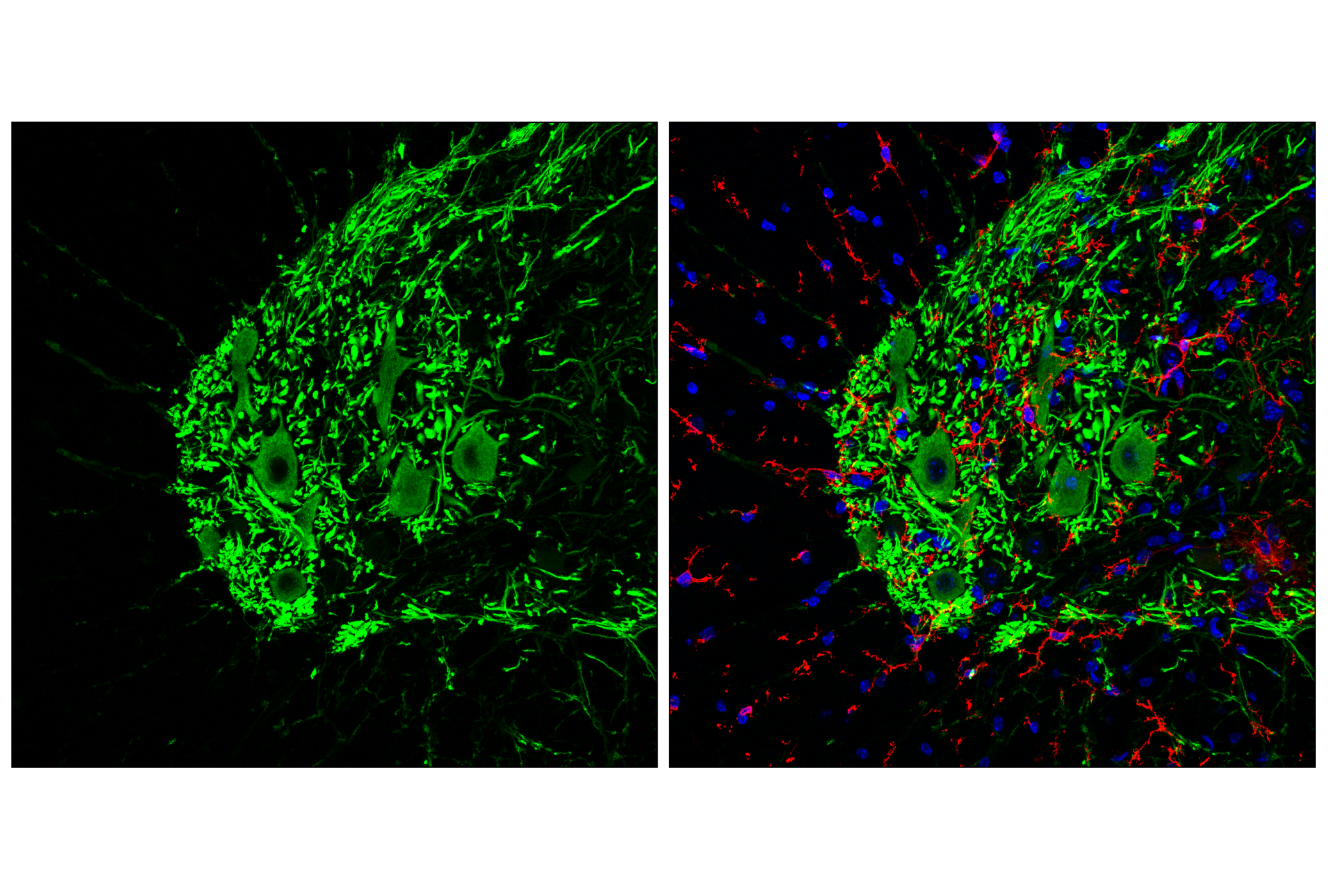 Immunofluorescence Image 2: GPR52 (E9D8W) Rabbit mAb