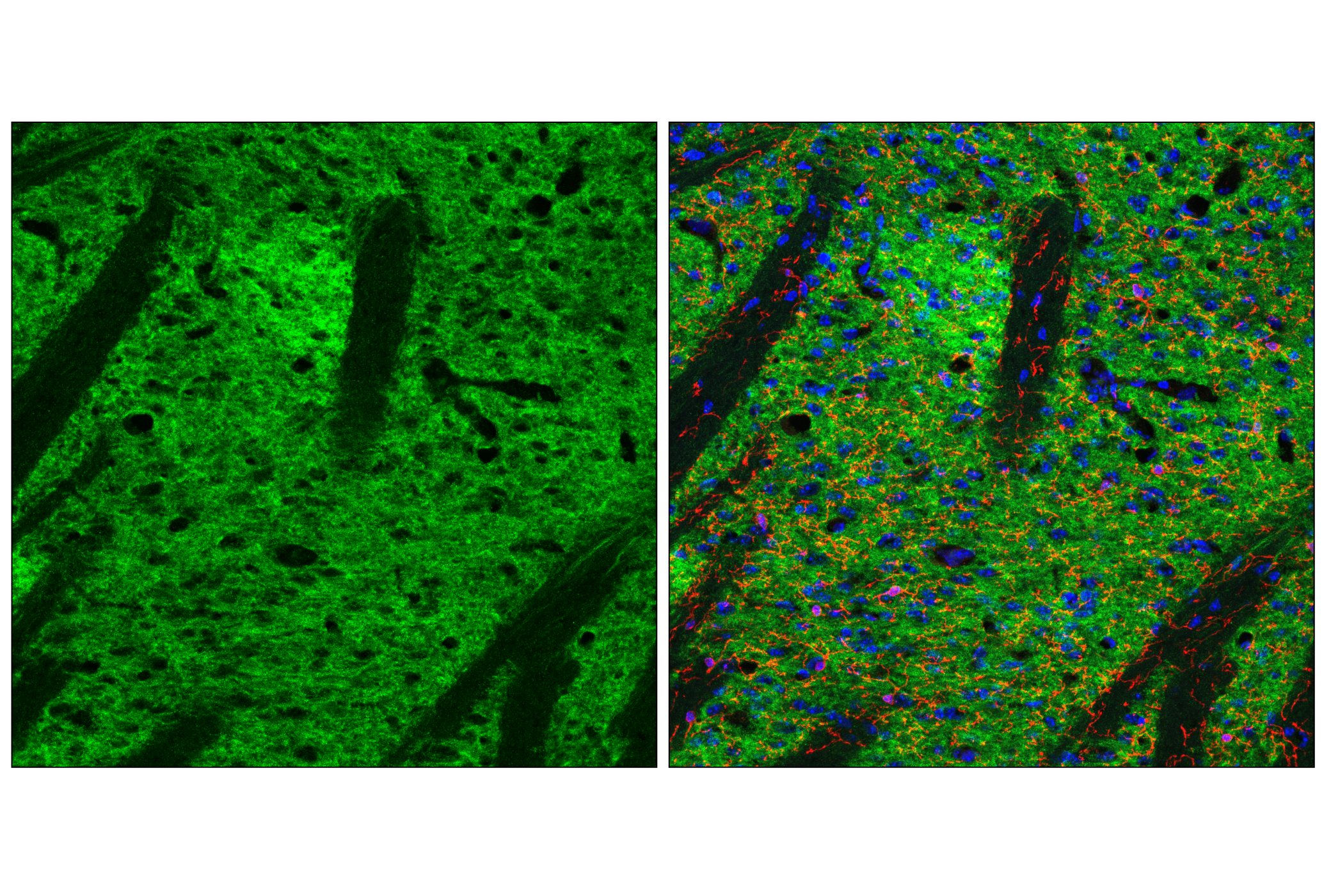 Immunofluorescence Image 1: GPR52 (E9D8W) Rabbit mAb