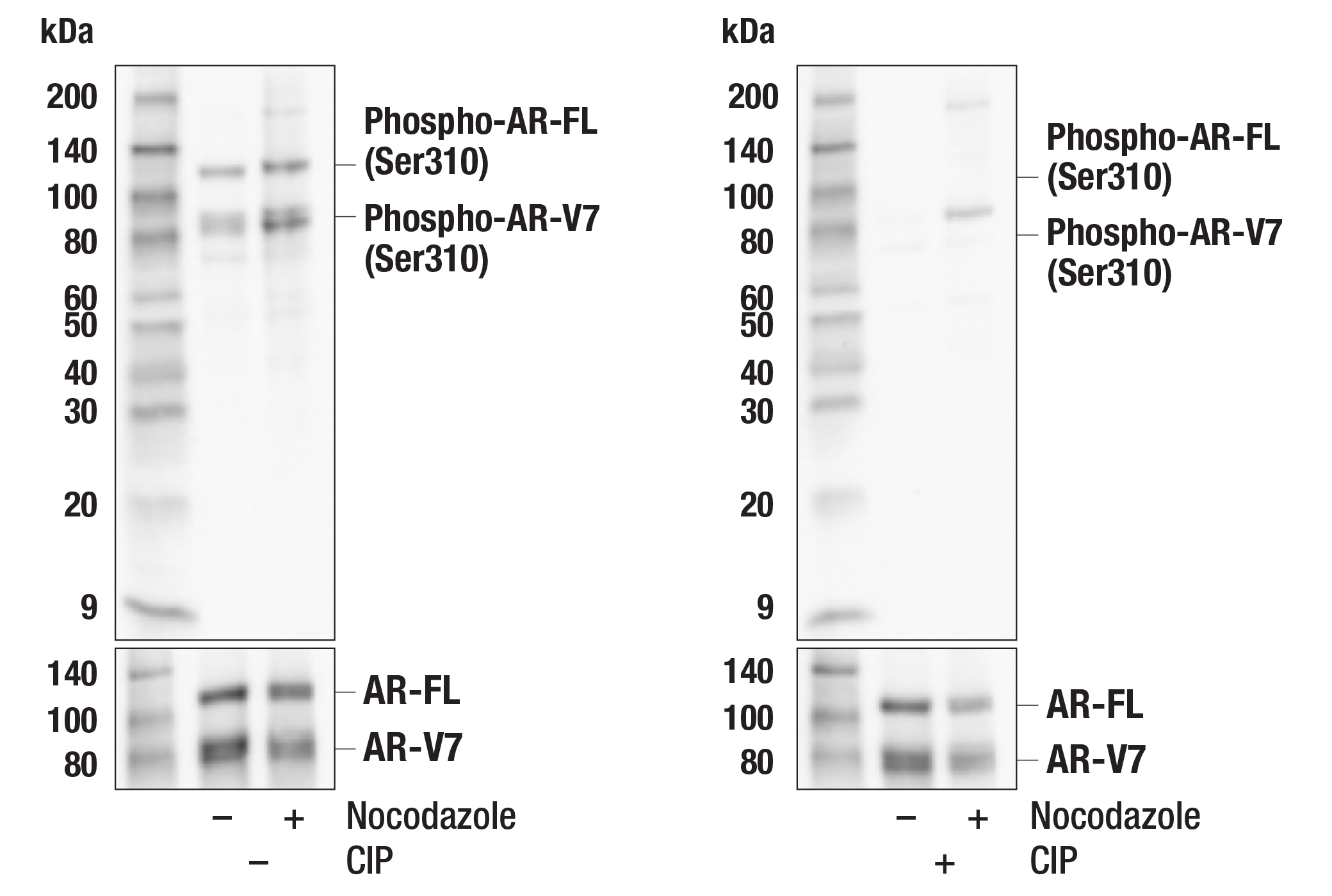  Image 5: PhosphoPlus® Androgen Receptor (Ser310) Antibody Duet