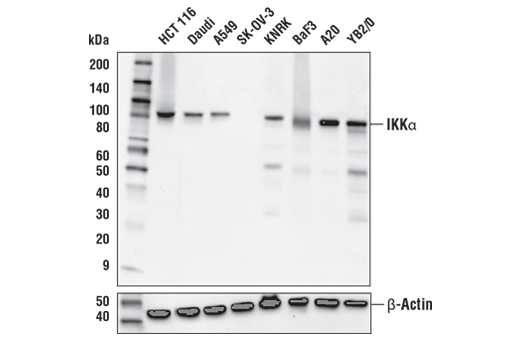  Image 11: NF-κB Pathway Antibody Sampler Kit II