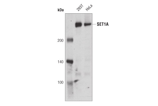  Image 8: SET1/COMPASS Antibody Sampler Kit