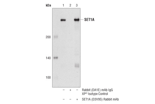 Immunoprecipitation Image 1: SET1A (D3V9S) Rabbit mAb