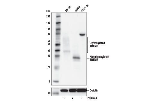 Western Blotting Image 1: TREM2 (E6T1P) Rabbit mAb (Amino-terminal Antigen)