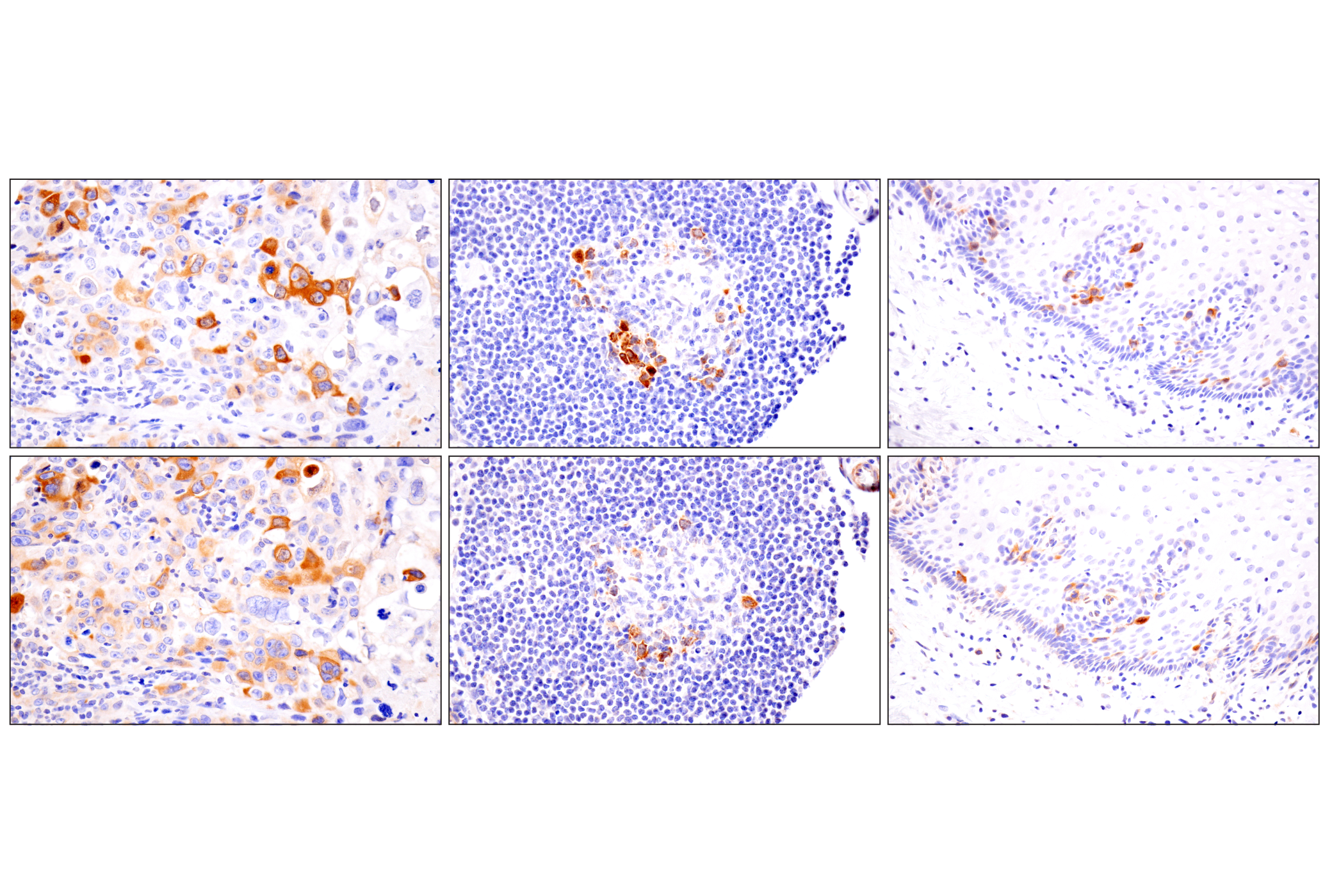Immunohistochemistry Image 8: Cyclin B1 (F7U1O) Rabbit mAb