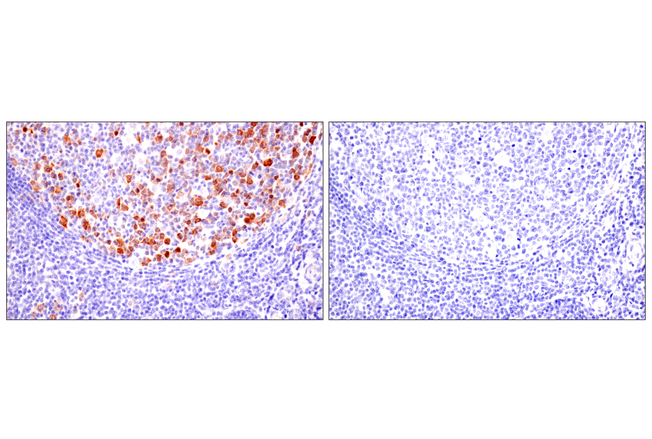 Immunohistochemistry Image 9: Cyclin B1 (F7U1O) Rabbit mAb