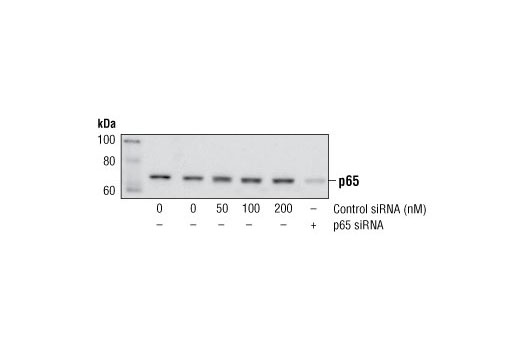  Image 1: SignalSilence® Control siRNA (Fluorescein Conjugate)