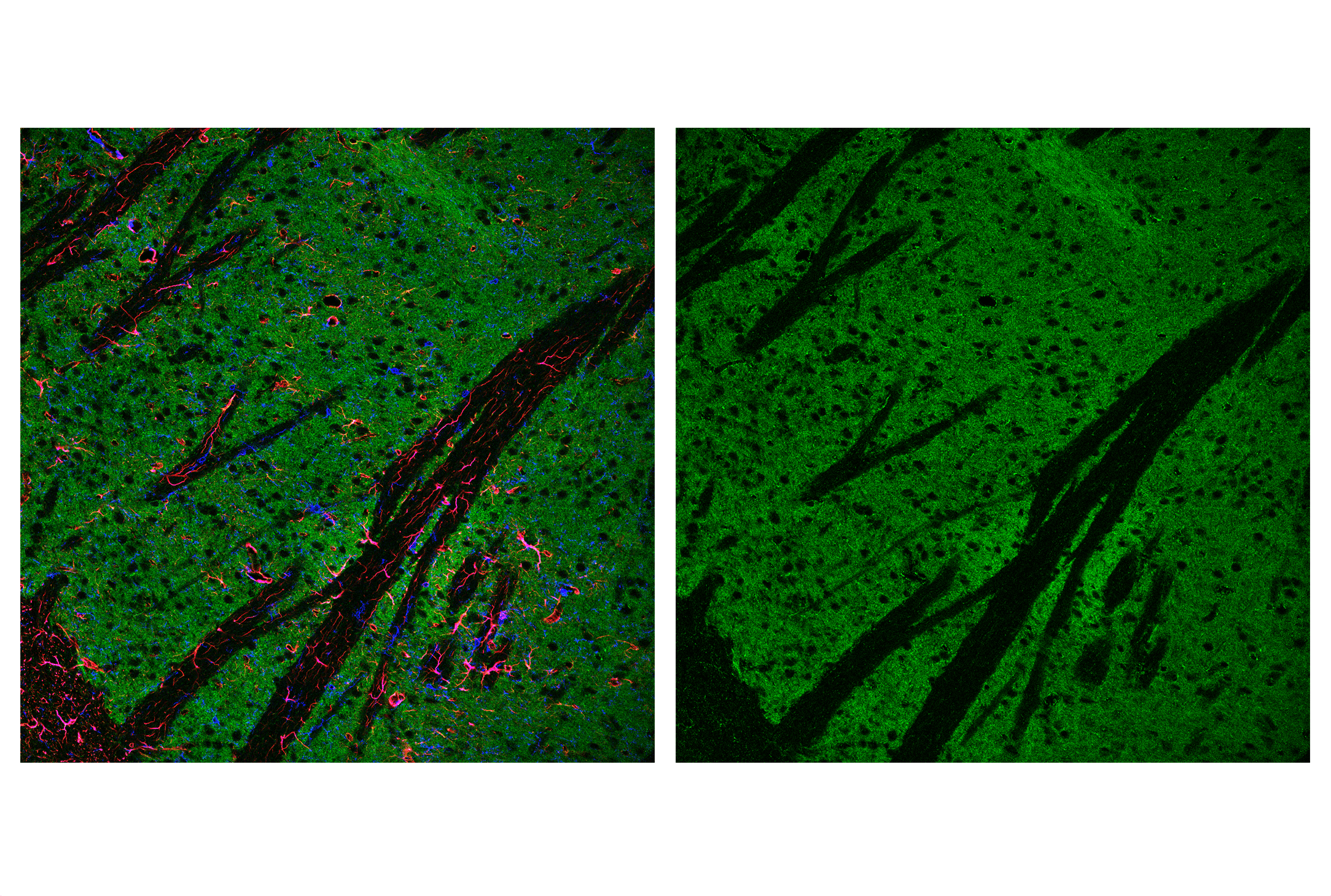Immunofluorescence Image 4: AIF (D39D2) XP® Rabbit mAb (BSA and Azide Free)