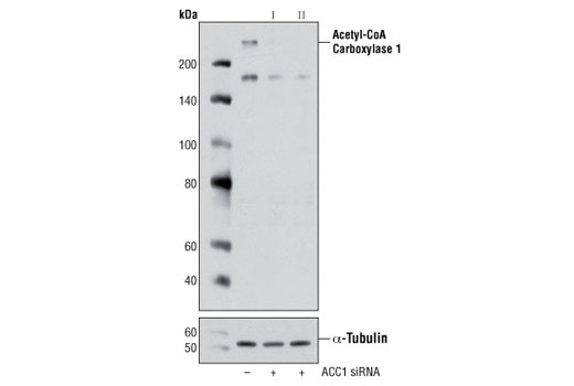  Image 1: SignalSilence® Acetyl-CoA Carboxylase 1 siRNA I